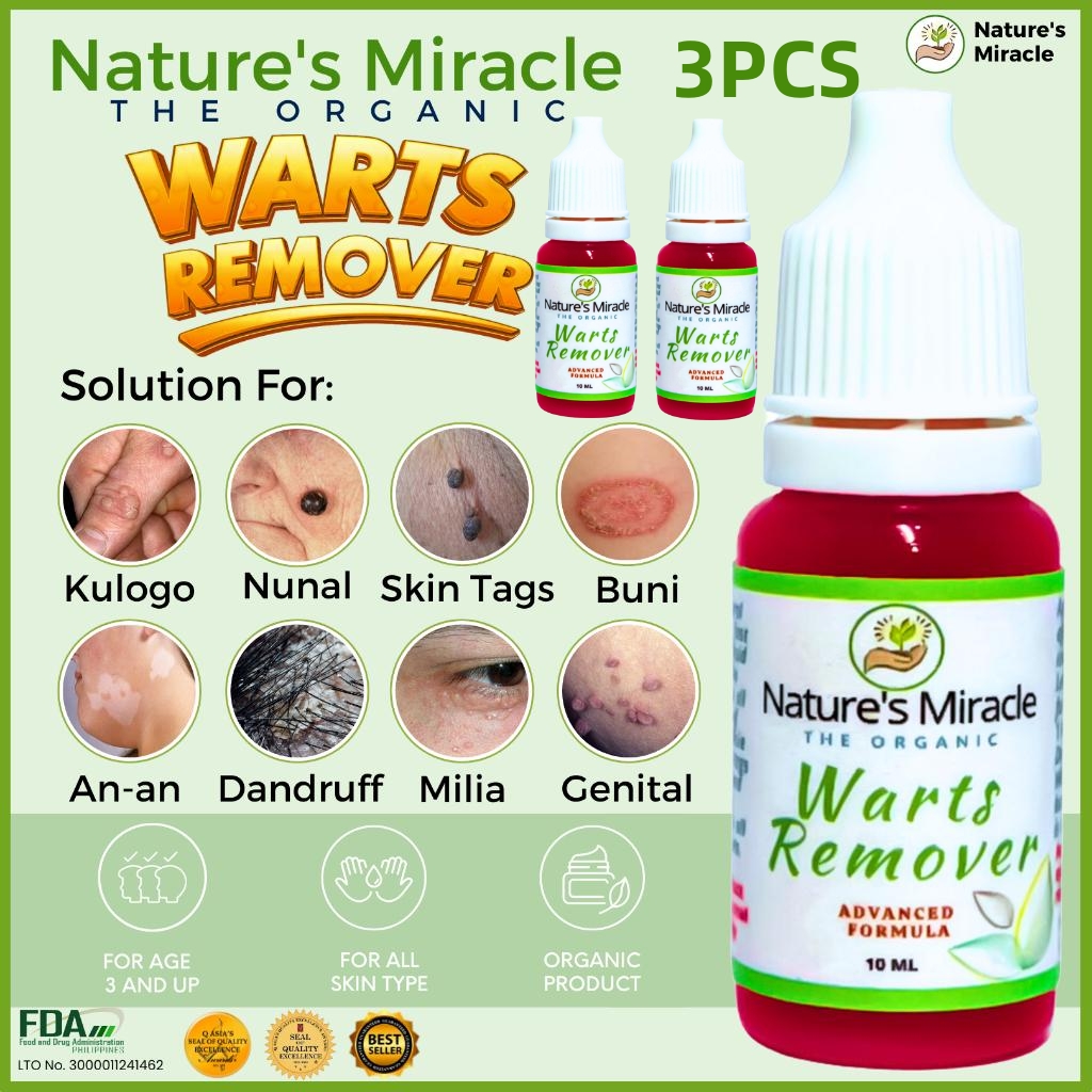 BUY 1 TAKE 2=3PCS Warts Remover Kasoy Oil Warts Remover Original Mole Remover Kulogo Buni Removal By Nature BUY 1 TAKE 2=3PCS Warts Remover Kasoy Oil Warts Remover Original Mole Remover Kulogo Buni Removal By Nature